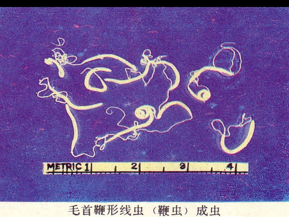 毛首鞭形线虫(鞭虫_第3页