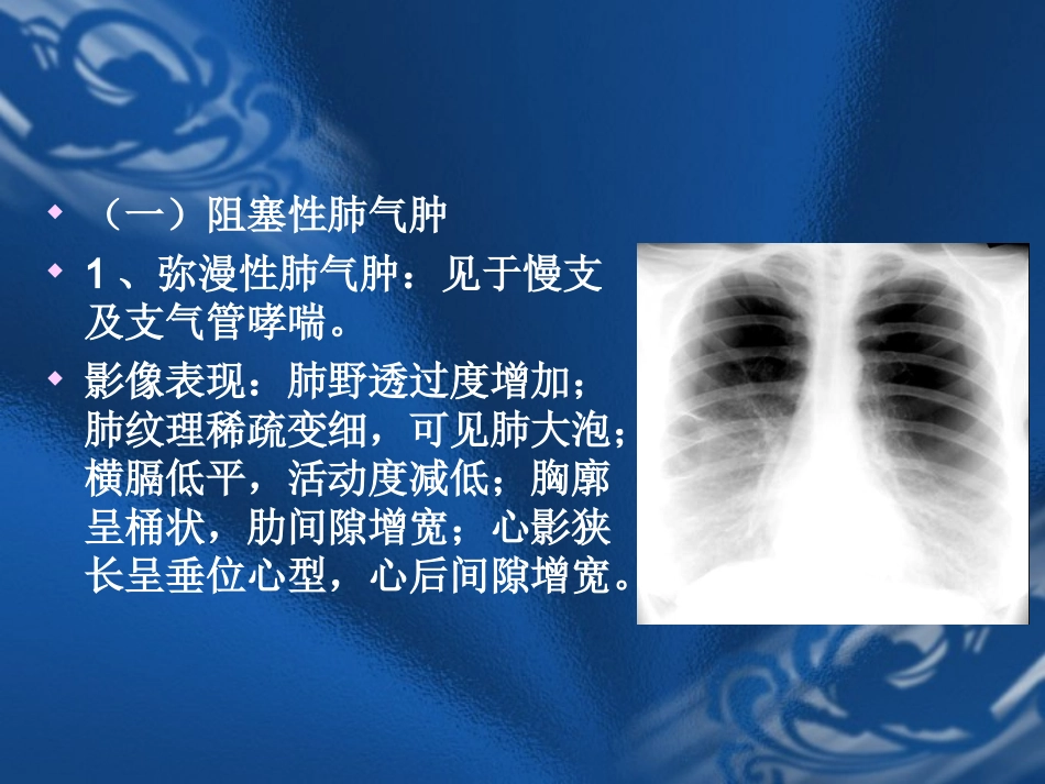 呼吸系统基本病变的影像学表现(新)_第3页