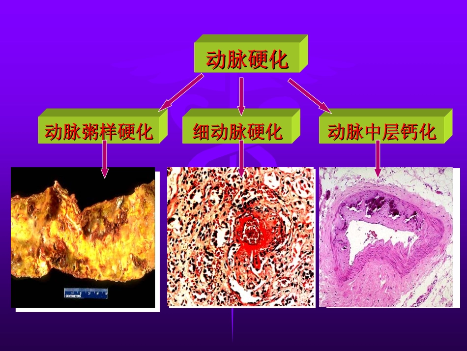 第六章 心血管疾病_第3页