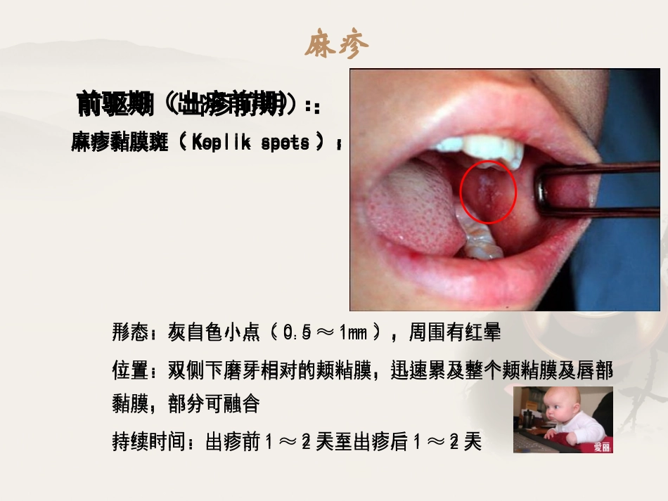 儿科-传染病介绍_第2页