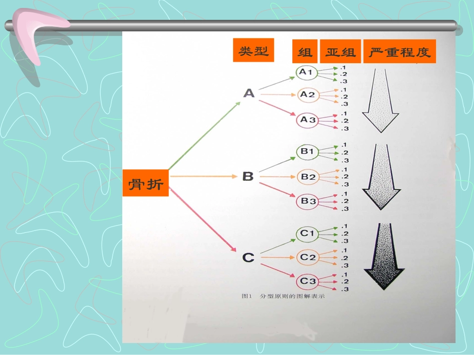 四肢长管状骨的-AO-综合分类_第3页
