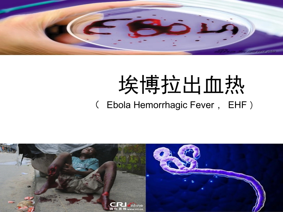 埃博拉疫情及秋冬常见传染病的防护_第3页