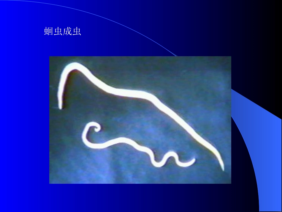 寄生虫实验全部图片复习_第2页