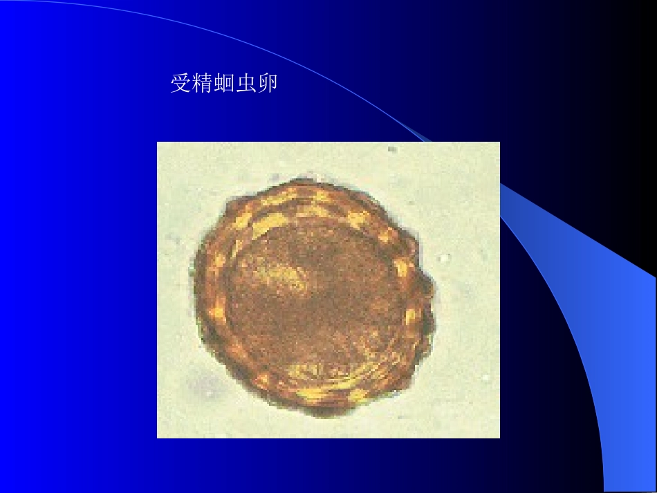 寄生虫实验全部图片复习_第3页