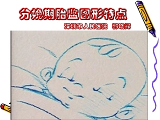 分娩期胎监变化特点(框架)