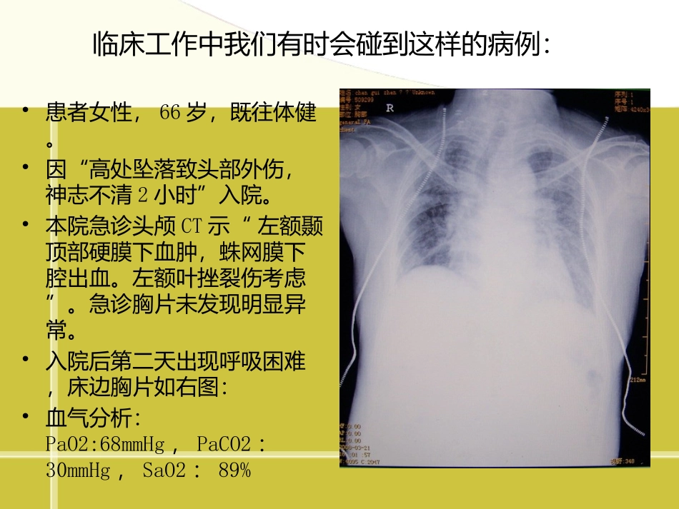 顽固性低氧血症的诊治_第2页