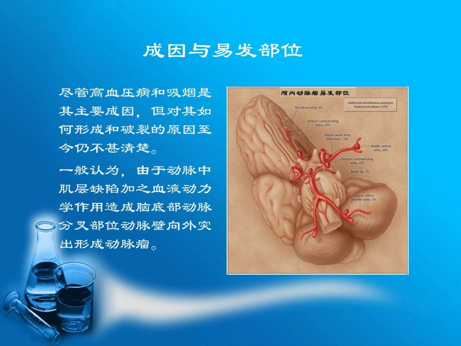 珠网膜下腔出血与动脉瘤_第3页
