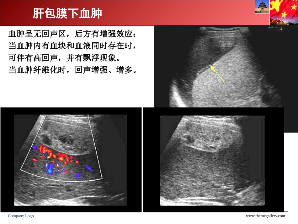 急诊超声的检查与分析_第3页