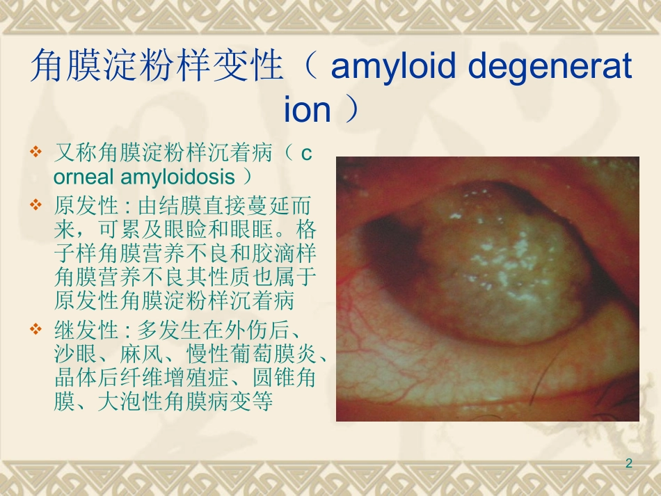 角膜脂肪变性_第2页