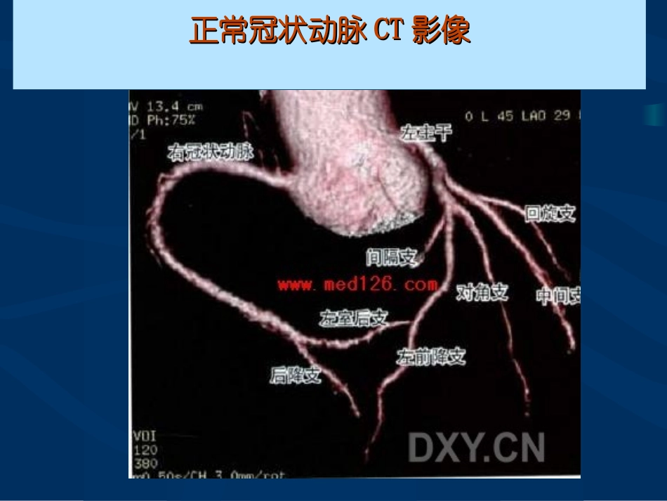 急性心肌梗死的紧急救治_第3页