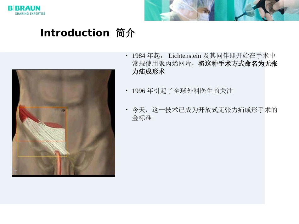 李金斯坦无张力疝手术方法步骤_第2页