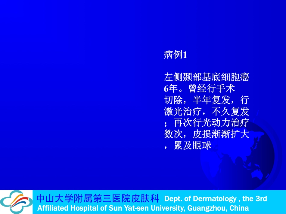 Mohs外科_第3页