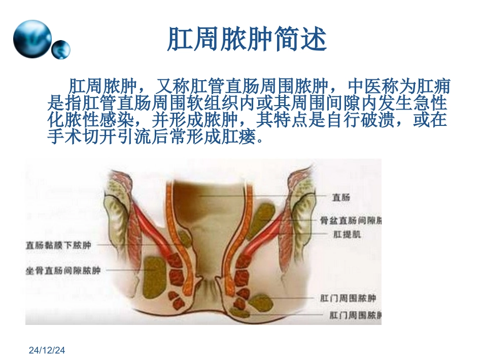 一例肛周脓肿术后换药个案_第3页
