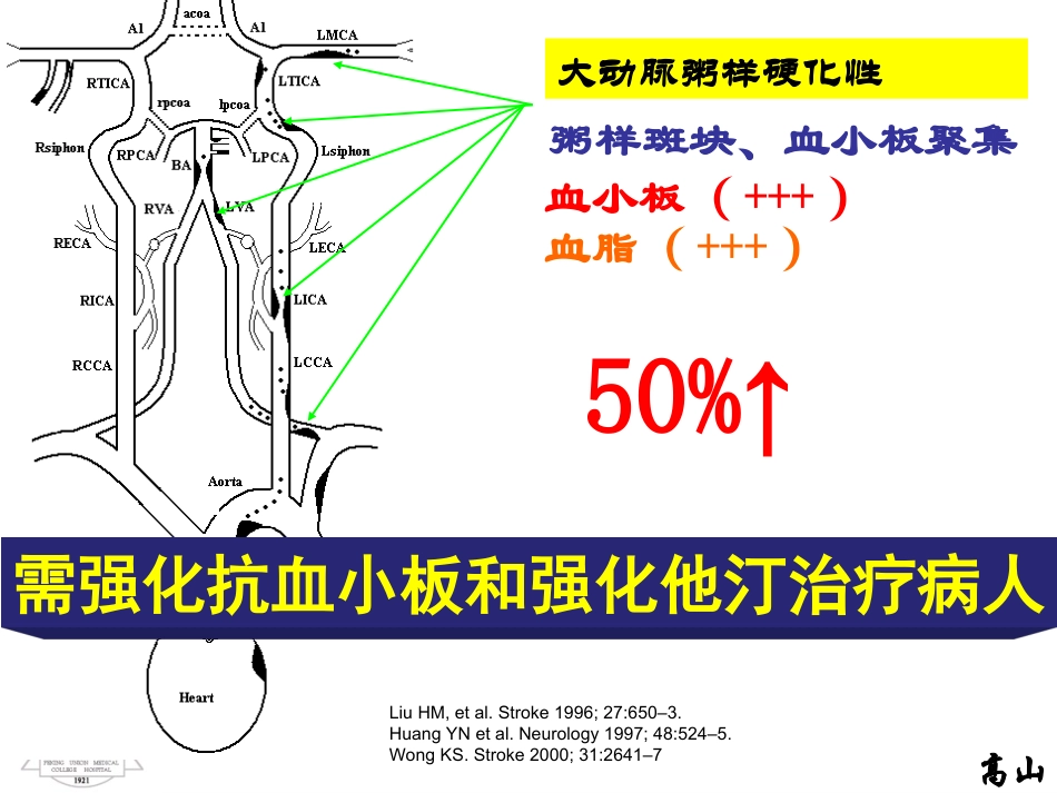 动脉粥样硬化性梗死分层病例_第3页