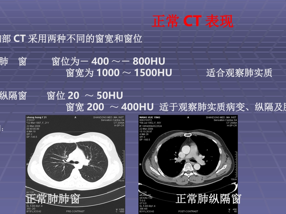 正常胸肺部CT影像学_第2页