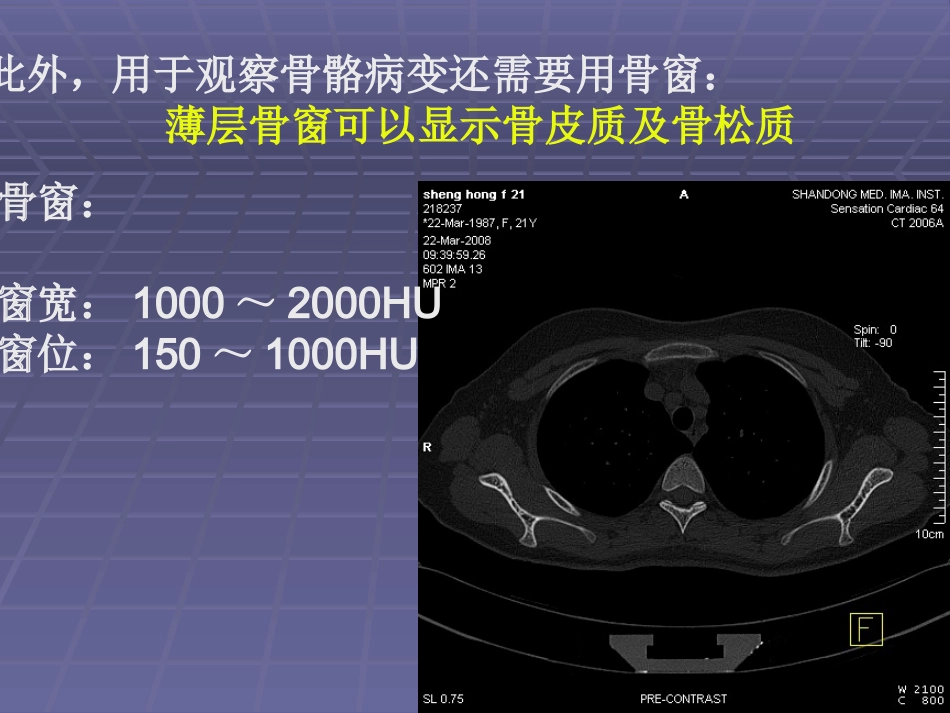 正常胸肺部CT影像学_第3页
