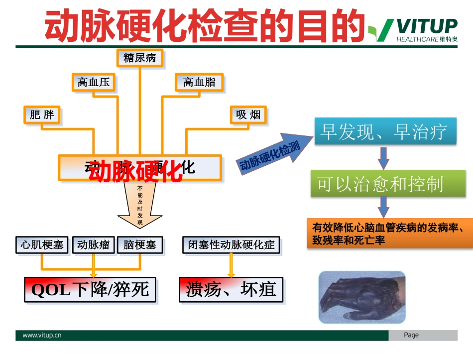 维特奥动脉硬化_第3页