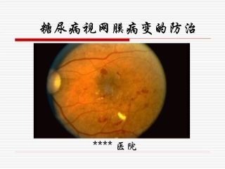 糖尿病视网膜病变宣教