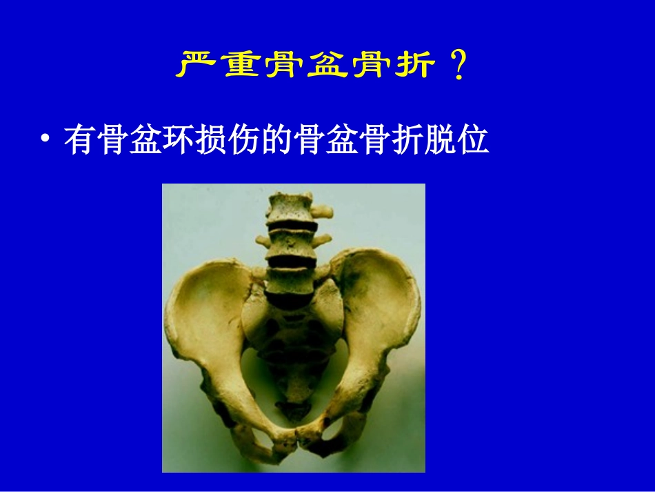 严重骨盆骨折的急救处理_第2页