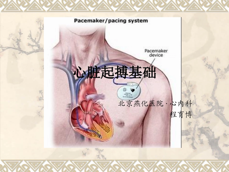 心脏起搏基础_第1页