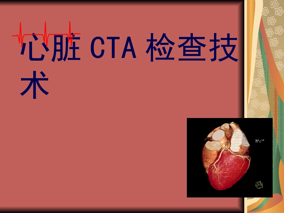 心脏CTA检查_第1页
