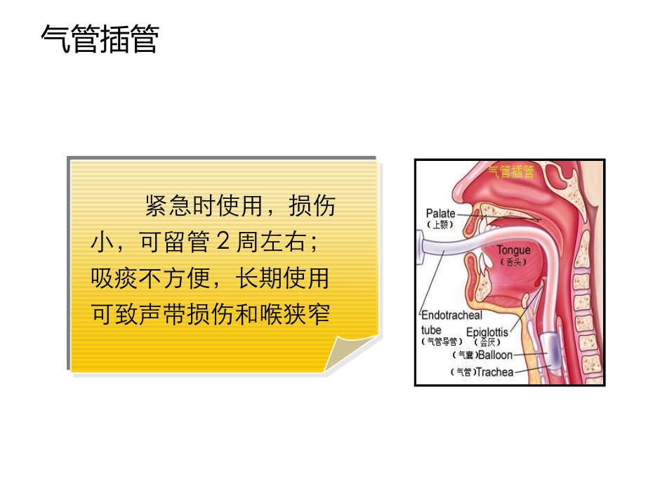 气管插管和气道湿化_第2页