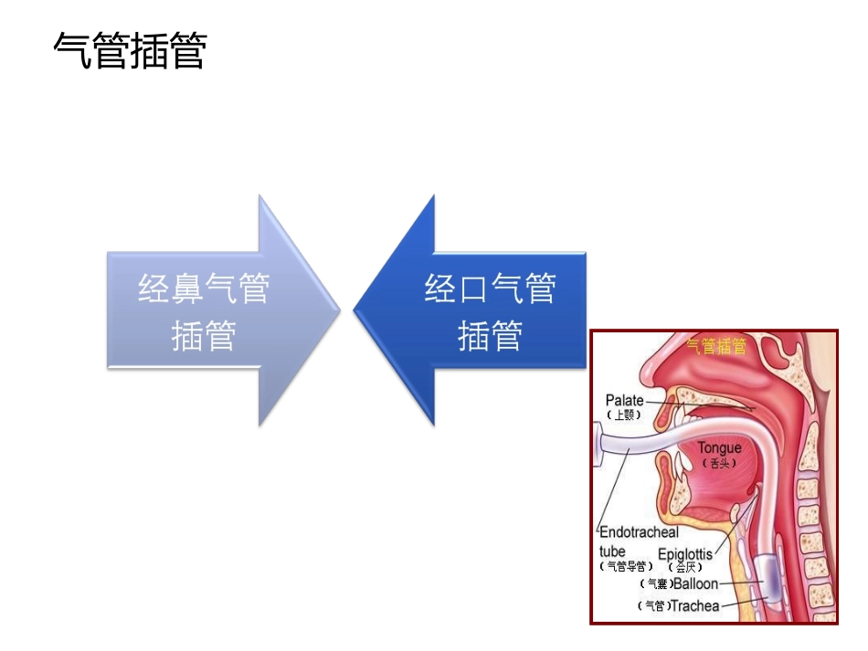 气管插管和气道湿化_第3页