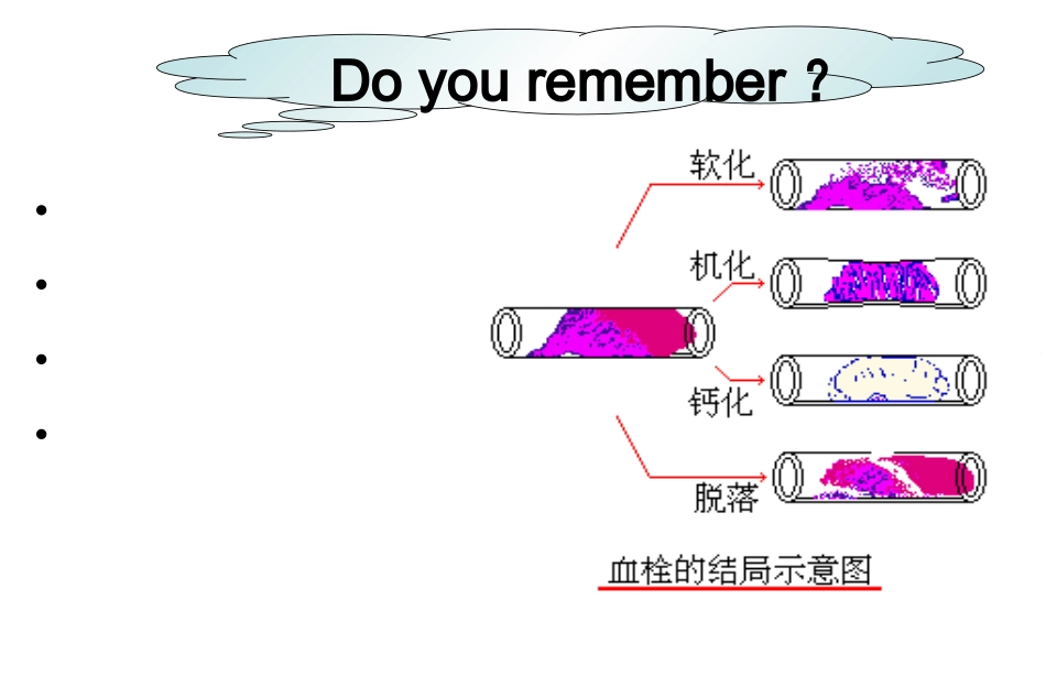 局部循环障碍2_第2页