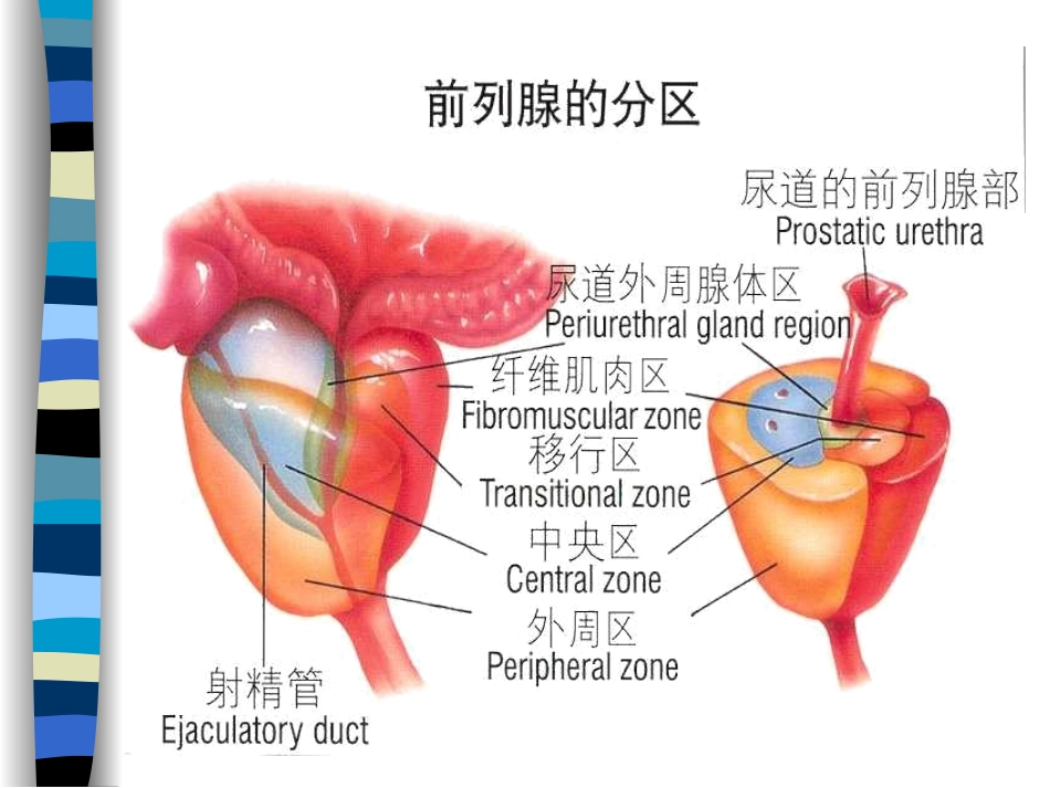 慢性前列腺炎-和男性不育_第2页