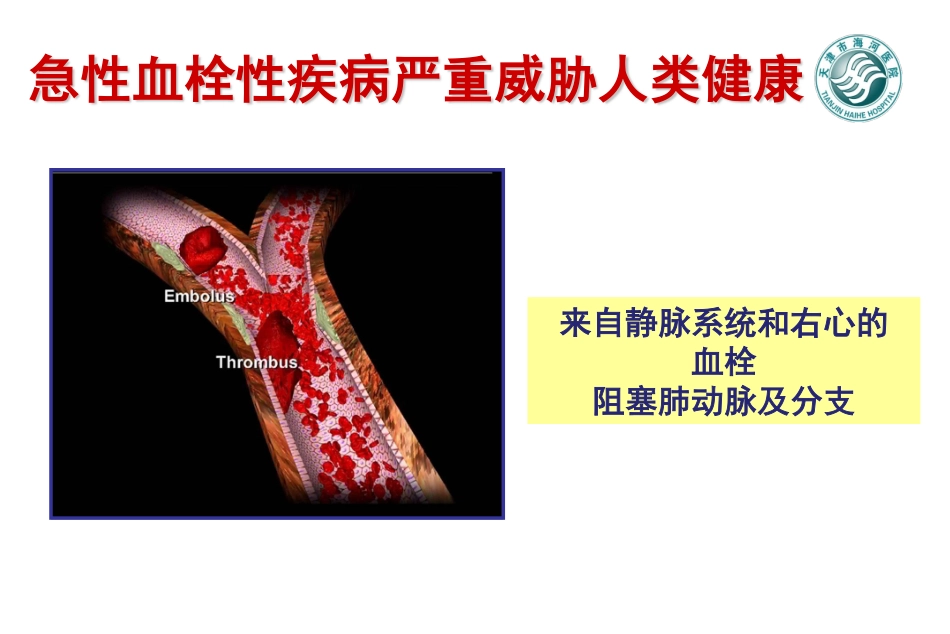 急性肺栓塞诊断与治疗_第3页