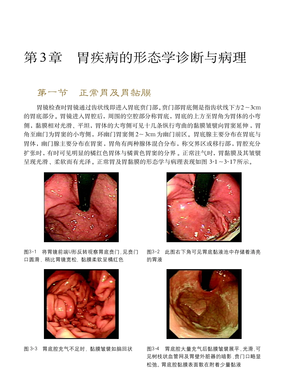 胃疾病的形态学诊断与病理_第1页