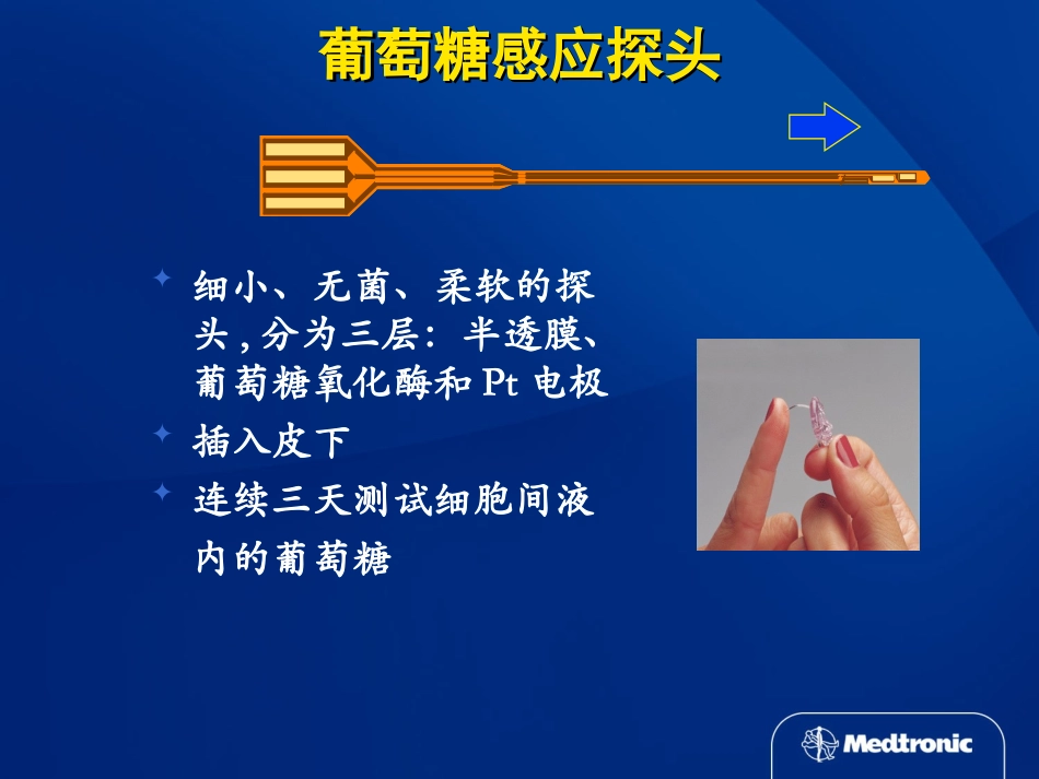 动态血糖仪及未来展望_第2页