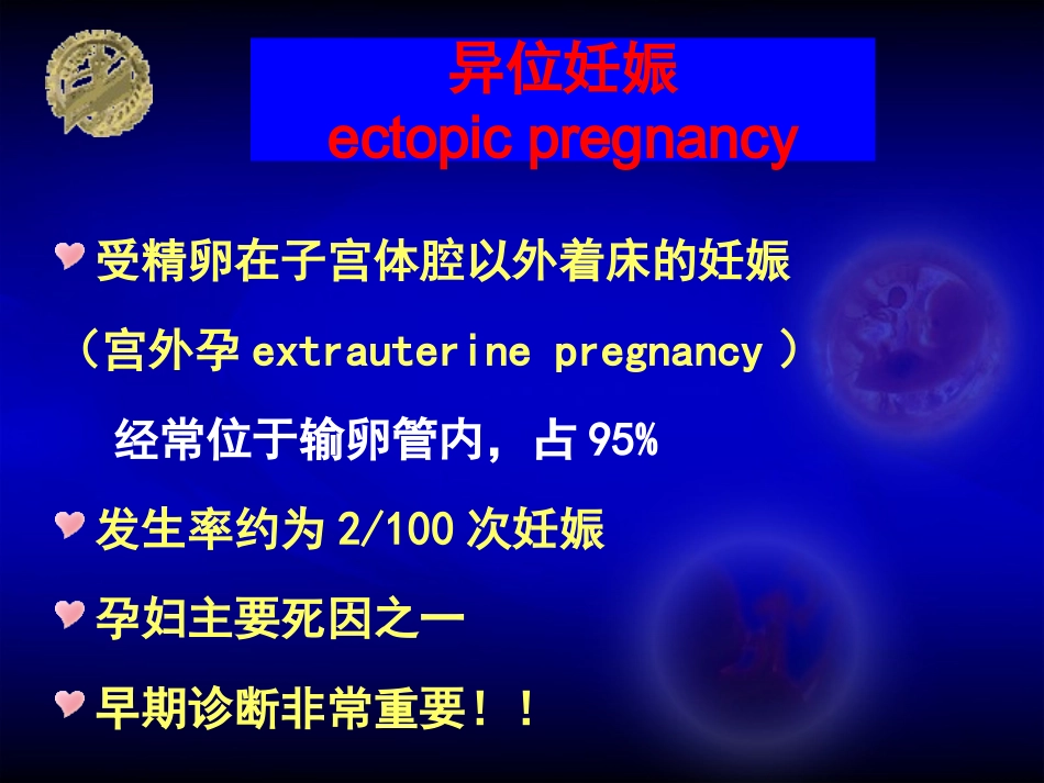 异位妊娠ep--new_第1页