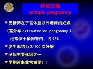 异位妊娠ep--new