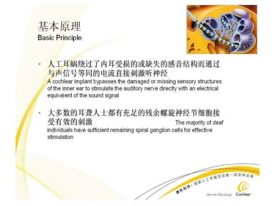 人工耳蜗工作原理_第2页