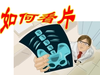 如何看颈腰椎X光片