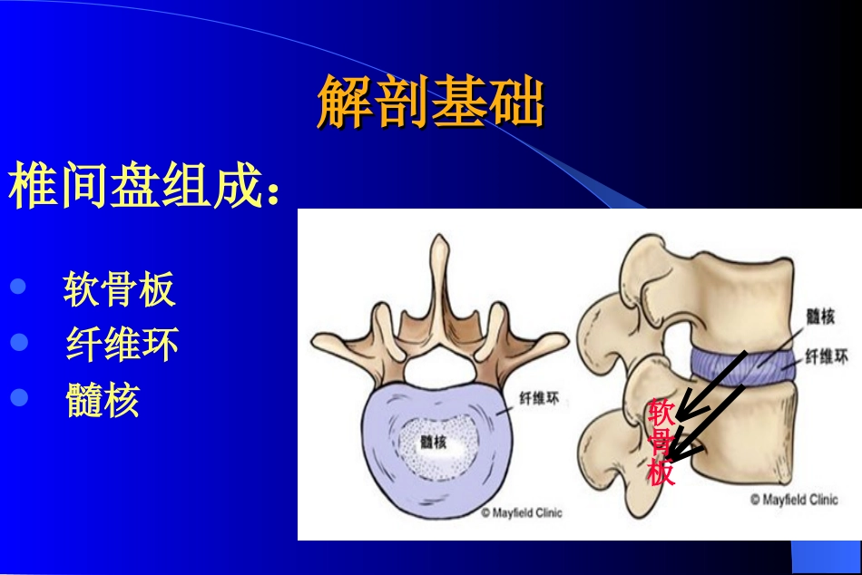 腰椎间盘突出症介绍_第3页