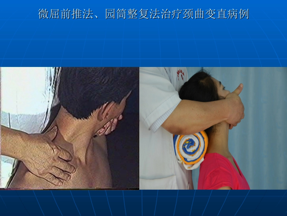 影象病例讨论_第3页