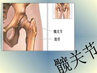 髋关节及其常见病