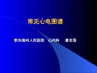 常见心电图谱