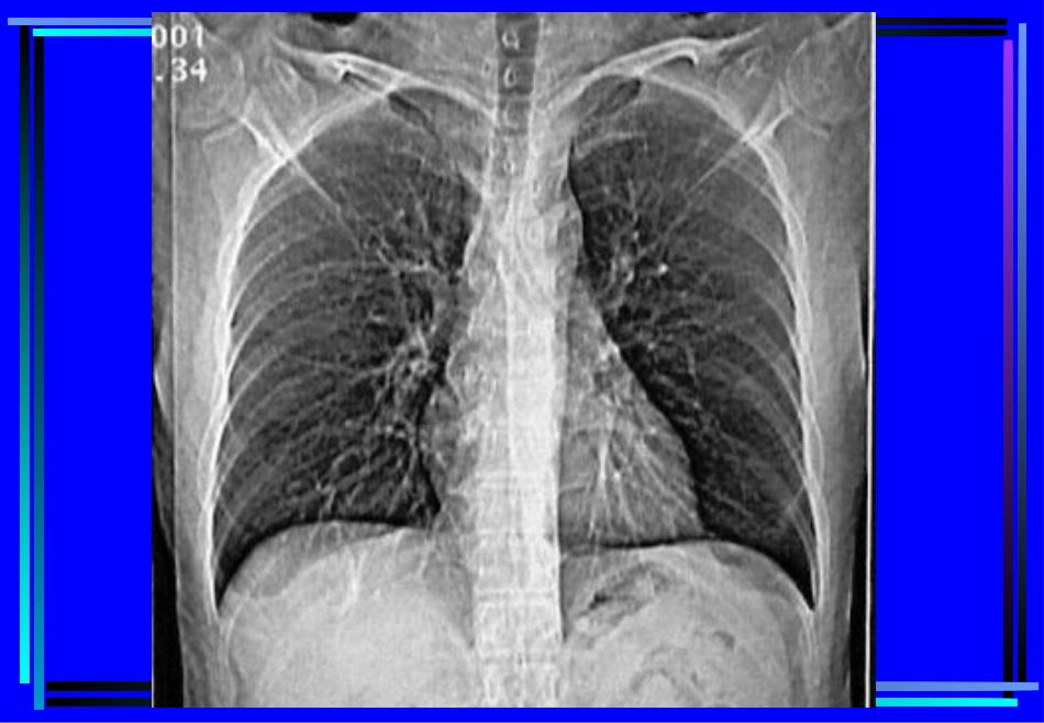 住院医师胸部CT诊(超量实例CT片)_第2页