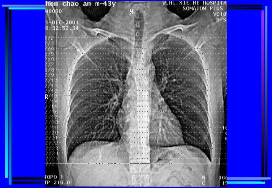 住院医师胸部CT诊(超量实例CT片)_第3页