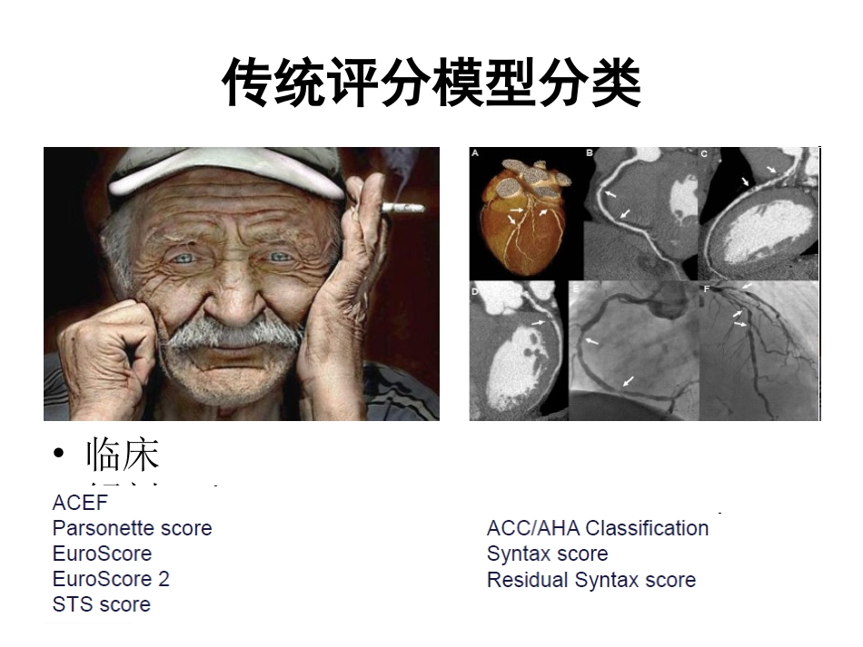 冠心病危险评分与决策N_第3页