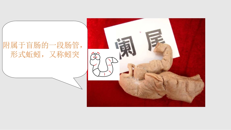 阑尾炎影像学_第2页