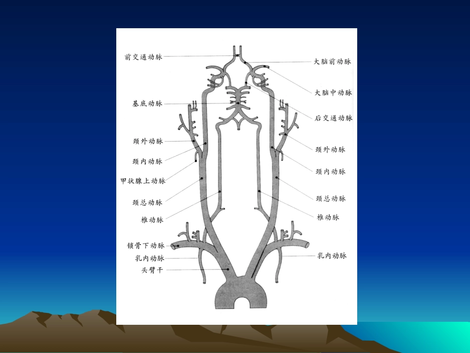 锁骨下动脉窃血_第3页