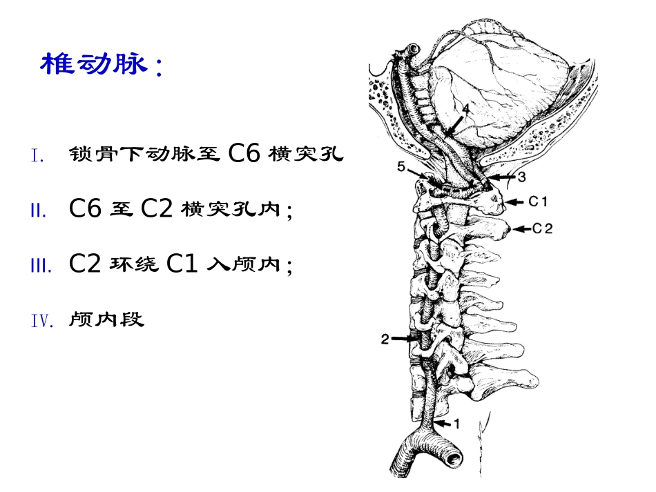 椎基底动脉卒中诊治_第3页