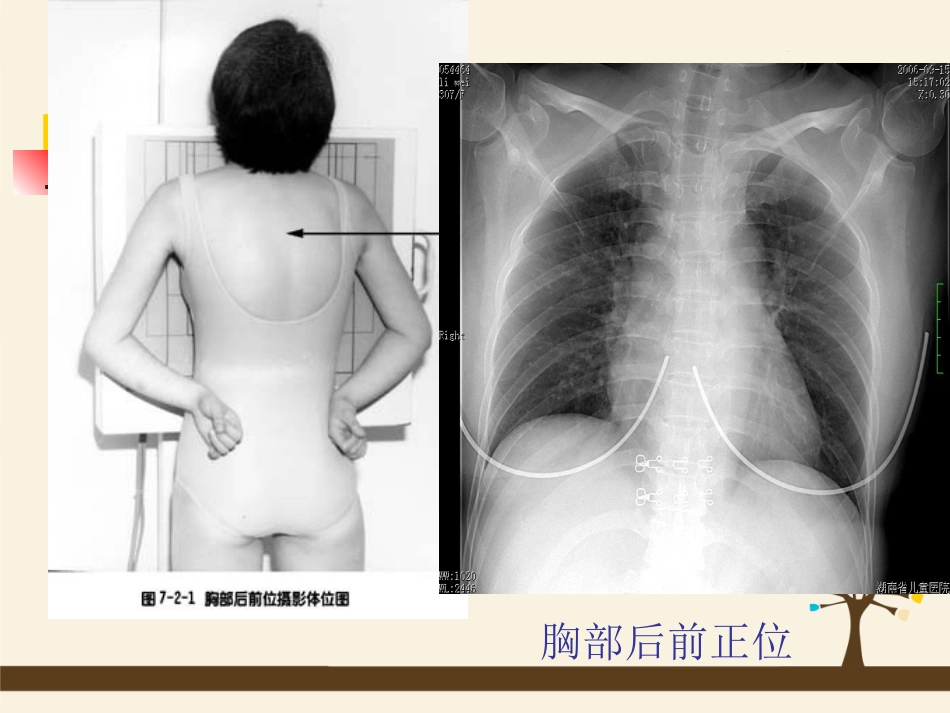 呼吸、循环、消化、泌尿影像学_第2页
