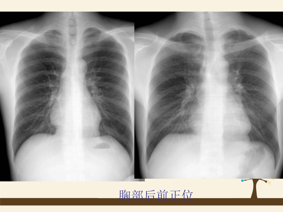 呼吸、循环、消化、泌尿影像学_第3页