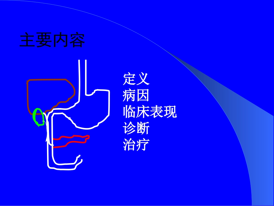 上消化道出血的处理_第2页