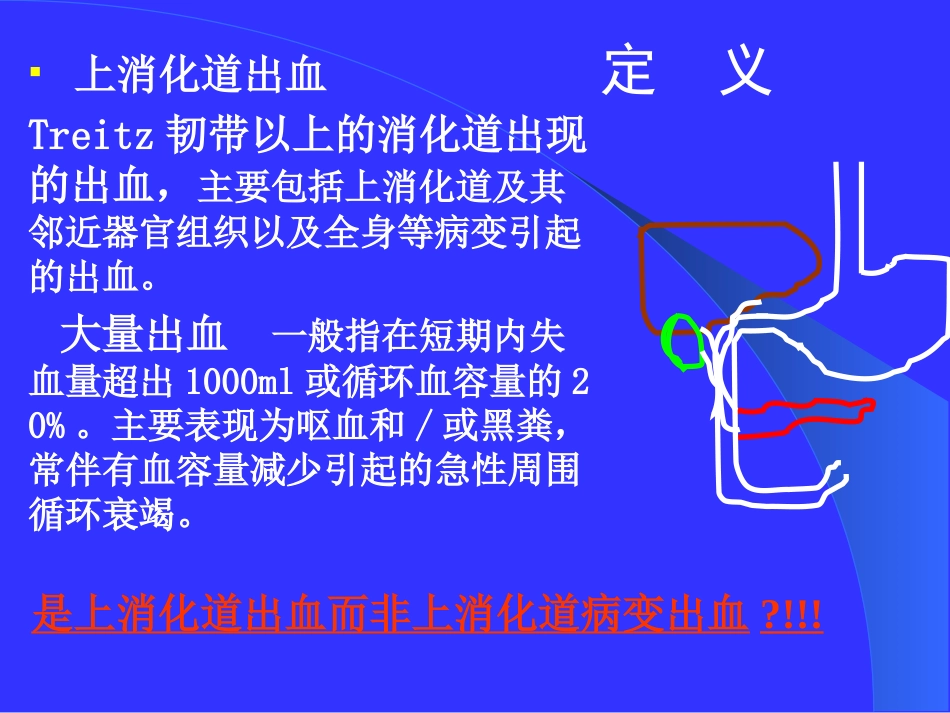 上消化道出血的处理_第3页